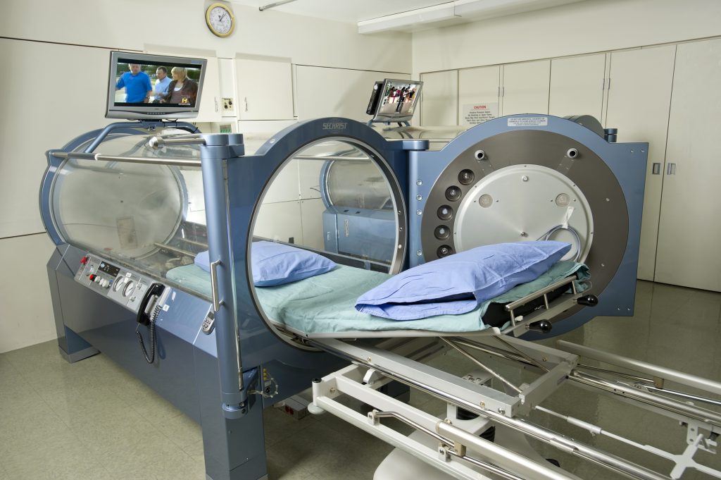 Questa immagine ha l'attributo alt vuoto; il nome del file è Hyperbaric_chamber_image-1024x681.jpg